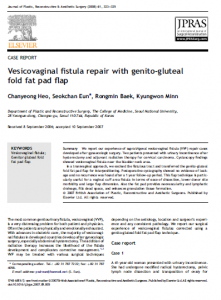 Vesicovaginal fistula repair with genito-gluteal fold fat pad  flap